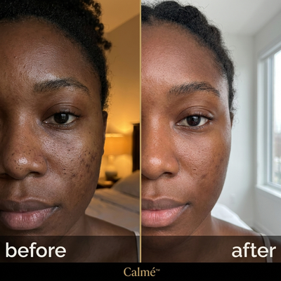 Calmé - Electric Barrier Cleanser